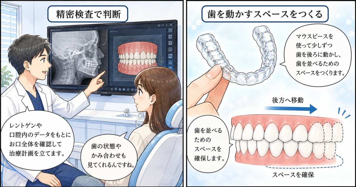 歯列矯正のみで改善を目指せるケースと外科的処置が視野に入る基準