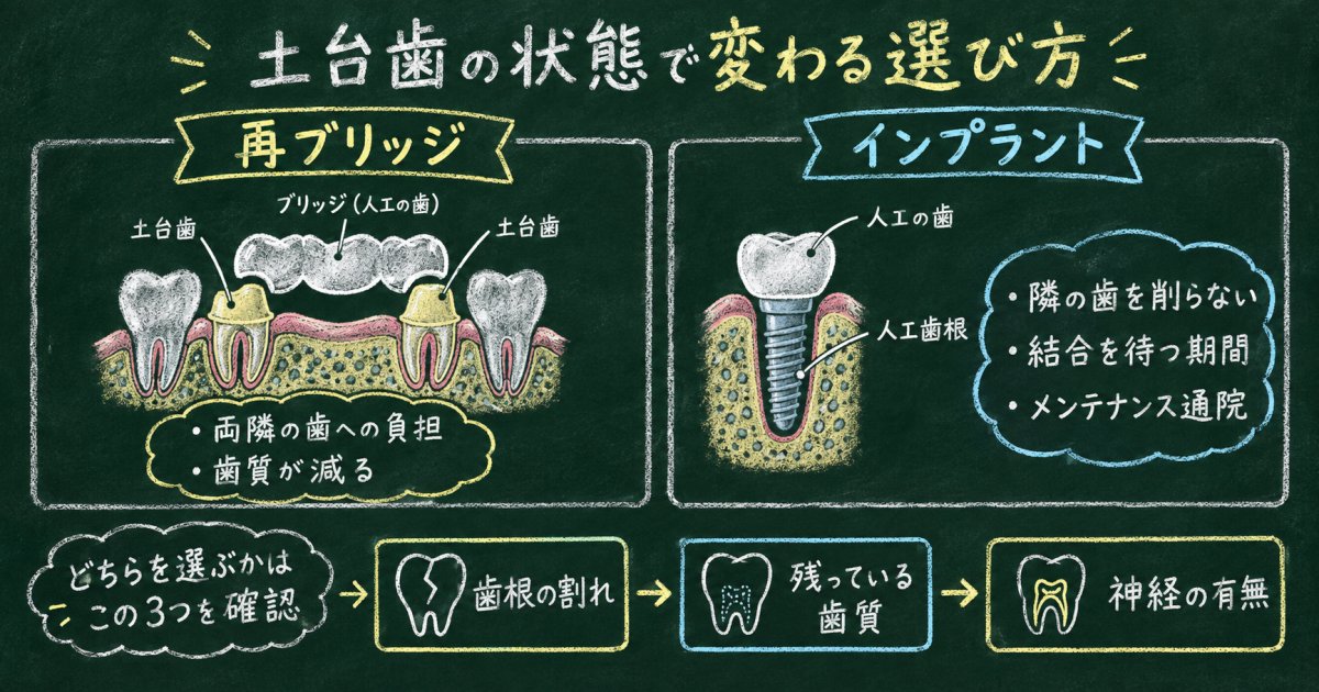 土台歯の状態別に見る再ブリッジとインプラントのやり直しリスク