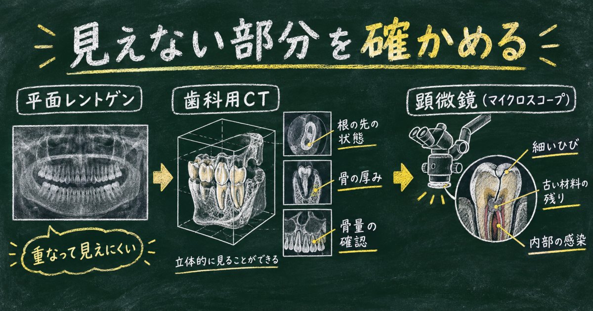 歯科用CTとマイクロスコープによる精密検査でわかること