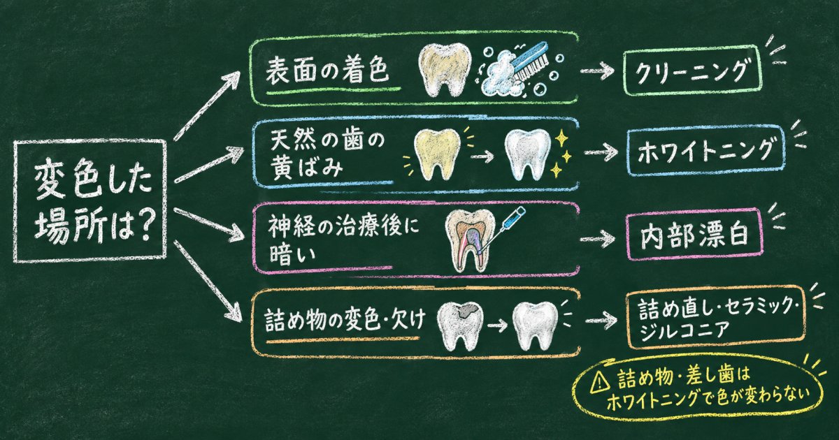 前歯を白くする治療は、変色した場所と歯の状態で選ぶ