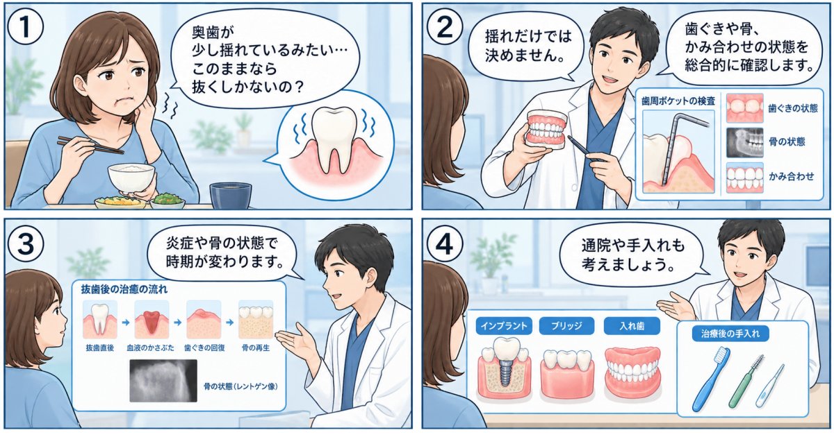 歯周病で奥歯が揺れる…抜歯か保存か、インプラントの時期は？