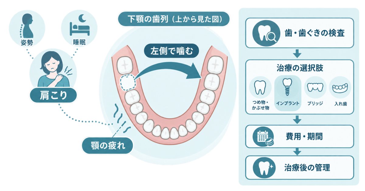 奥歯の欠損で片側噛み・顎が疲れる？肩こりとインプラントの考え方