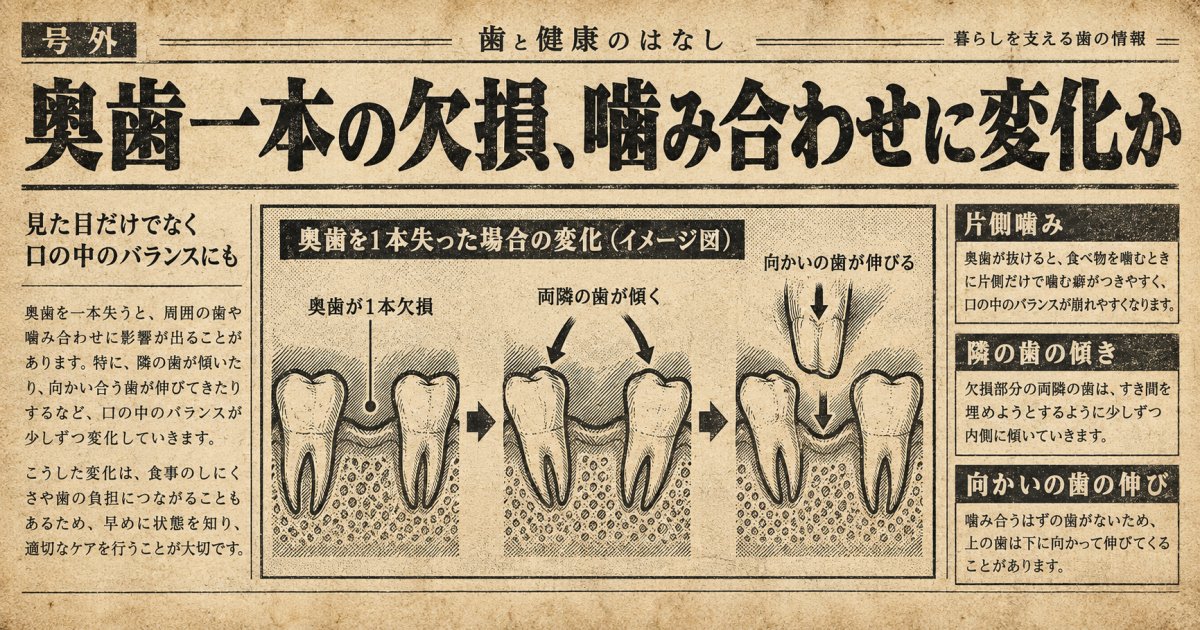 奥歯を失うと、噛み合わせのバランスはどう変わる？